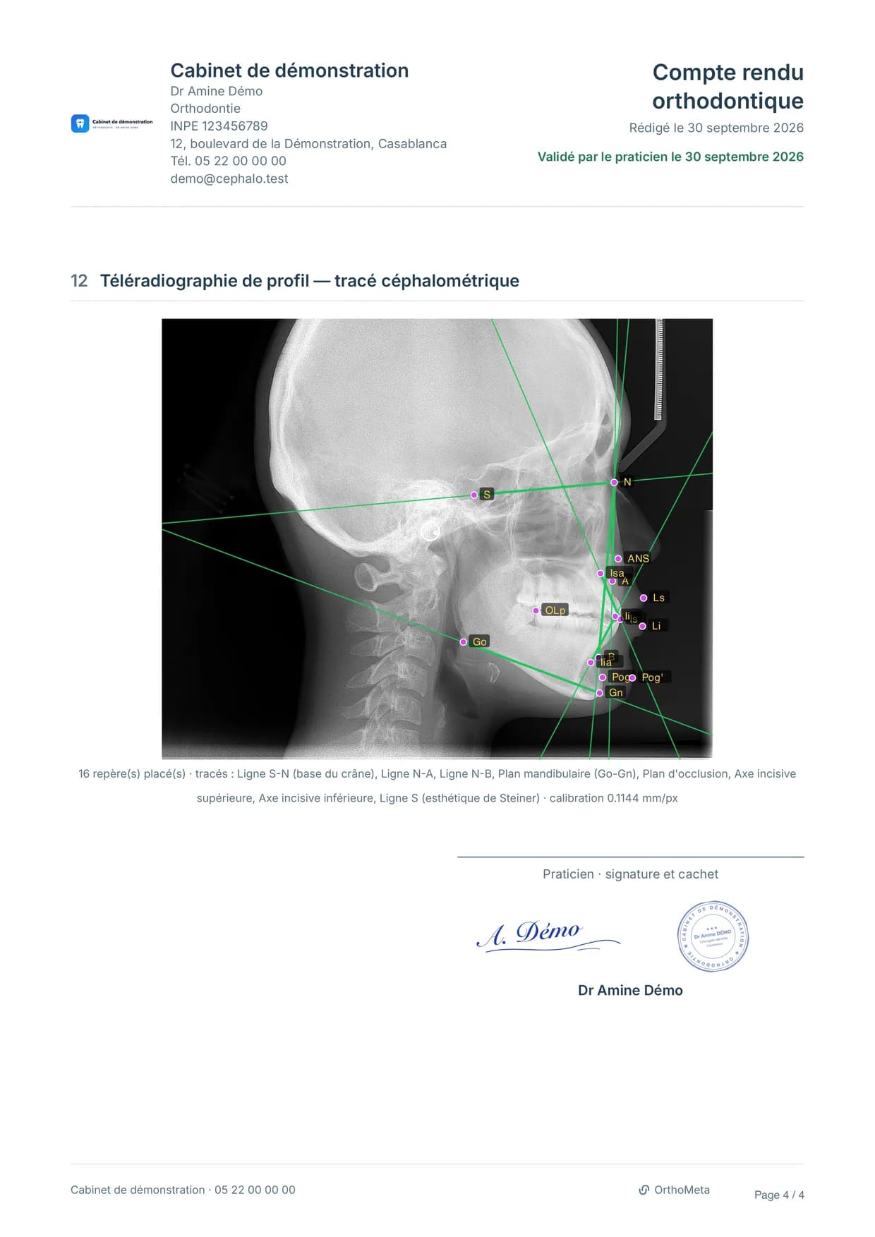 Compte rendu en PDF à l’en-tête d’un cabinet de démonstration : radiographie annotée, signature et cachet du praticien.